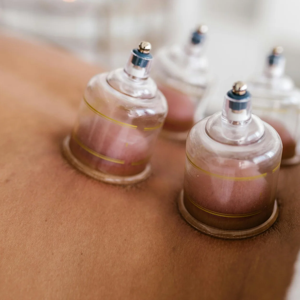 Hijama bei AYA Viva Zürich